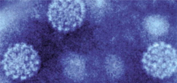 Auch Frauen über 18 Jahren profitieren von einer HPV-Impfung Humane Papillomaviren unter dem Elektronenmikroskop. Die Erreger verursachen Zervix-Karzinome.