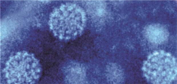 Neuer HPV-Impfstoff in Entwicklung Humane Papillomviren im Elektronenmikroskop.