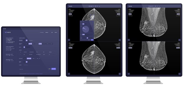 Start-up sammelt 6,5 Millionen Euro für KI-Tool ein Hundertprozentig unauffällige Mammographie-Aufnahmen sollen von Varas KI erkannt und mit einem automatischen Befund versehen werden.