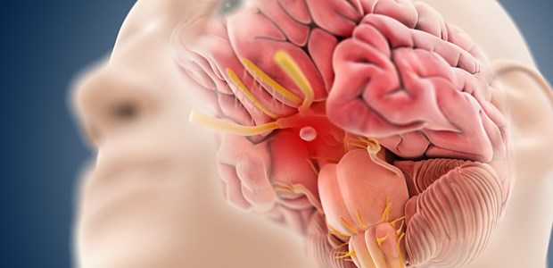 Hypophyse im Blick: Auch nach einer Op haben M.-Cushing-Patienten eine erhöhte Mortalität.