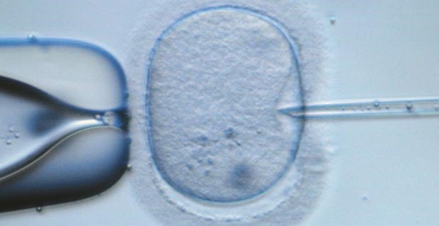 Gleiches Recht für beide ICSI: Ein Blick auf das Erbgut darf nicht einfach verboten werden, findet der EGMR.