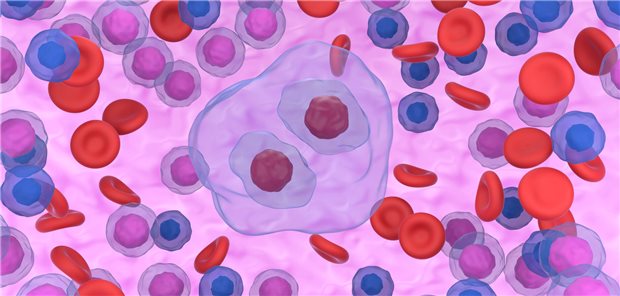 Illustration eines Hodgkin-Lymphoms umgeben von Blutkörperchen