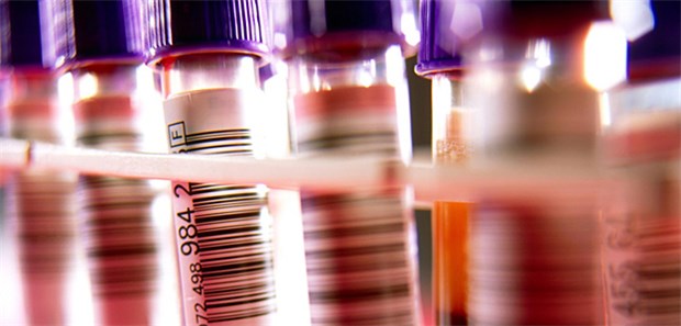 Marker im Blut für Resistenz Im Blut wurde ein RNA-Marker identifiziert, der eng mit Resistenzen gegen Abirateron und Enzalutamid assoziiert ist.
