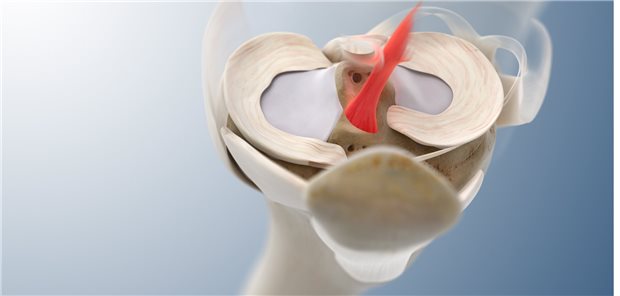 Im Fokus: Das vordere Kreuzband.