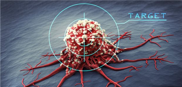 Apoptose-Bremse gelockert: Vorteil bei HNO-Tumoren Im Fokus: Krebszelle und ihre Apoptose.