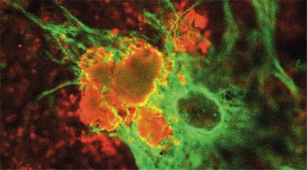 Dringend gesucht: Arzneien gegen -Amyloid und entgleiste Enzyme Im Fokus der Alzheimer-Forscher: b-Amyloid-Protein (orange).