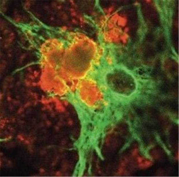 Neue Ansätze gegen Alzheimer mit Antibiotika und Farbstoffen Im Fokus der Forscher: b-Amyloid-Protein (orange).
