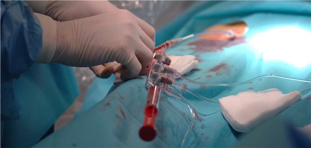 Im Herzkatheterlabor: Stenosen bei KHK-Patienten werden oft mit perkutanen Koronarinterventionen behandelt. Der Nutzen der Revaskularisation bei fehlender Symptomatik ist jedoch weiterhin unklar.