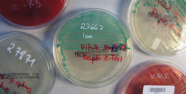 Keim außer Kontrolle - aber warum? Im Labor wird festgestellt, gegen welche Antibiotika die MRSA-Keime resistent sind.