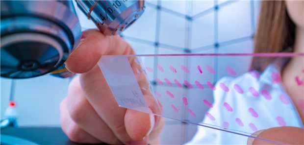 Im Laboralltag drohen Engpässe. Der VDGH unterstreicht daher die Dringlichkeit einer umfassenden Überarbeitung des bestehenden Rechtsrahmens, die durch die Evaluation der IVDR seitens der EU-Kommission unterstützt werde.