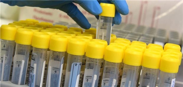 PCR-Test auf SARS-CoV-2 nach GOP 32816 wird zum 1. Juli deutlich abgewertet Im PCR-Labor bereitet eine medizinisch technische Laborassistentin die Bearbeitung von PCR-Tests in einem Automaten vor, die innerhalb von drei Stunden in dem Automaten analysiert werden. Labore sollen künftig für SARS-CoV-2-PCR-Tests nach EBM weniger Geld bekommen. (Archivbild)