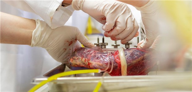 Der Trend, den Mutterkuchen zu essen Im Placenta-Labor wird die hormonelle Zusammensetzung von Plazenten untersucht.
