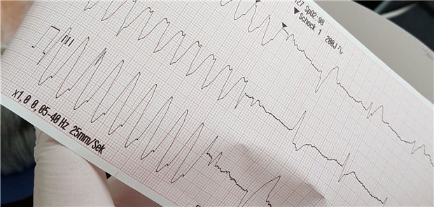 Innovationsprojekt QS-Notfall für die Regelversorgung? Im QS-Notfall-Projekt werden EKG digital vom Rettungsdienst an Notfallkliniken übertragen.