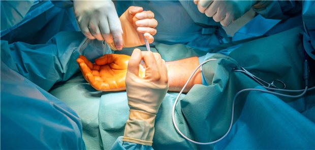 Nahaufnahme wie zwei Ärzte in einem Operationssaal einen Patienten an der Hand operieren.