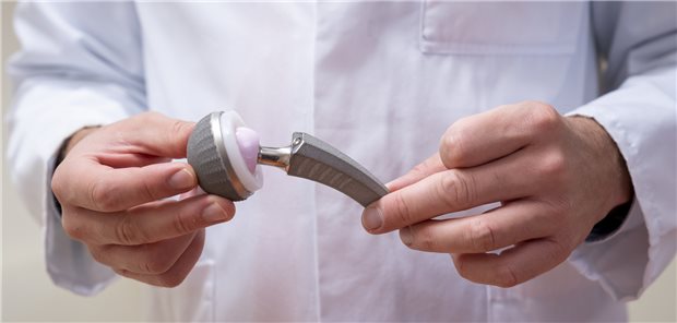 EPRD bietet sich als Turbo für Aufbau des Implantateregisters an Im Register erzählen Gelenkimplantate die Geschichte ihres Nutzens. Operateure können daraus wertvolle Informationen ziehen.