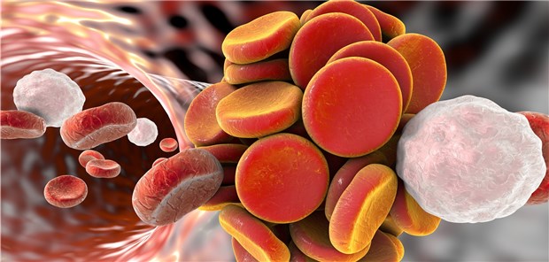 Im ersten Jahr erleiden 10 Prozent der Patienten mit einer ersten unprovozierten VTE ein Rezidiv.