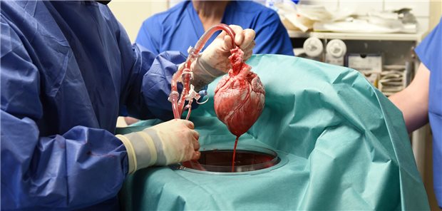 Im vergangenen Jahr 2022 wurde in den USA die erste Transplantation eines genetisch veränderten Schweineherzens auf einen Patienten vorgenommen. Hier das Herz des genmodifizierten Schweins, bevor es dem 57-Jährigen in Baltimore transplantiert wurde.