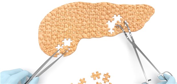 Immer mehr Puzzlesteine ergänzen das Wissen zum Krankheitsbild Pankreatitis.