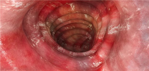 Darstellung der Darmschleimhaut