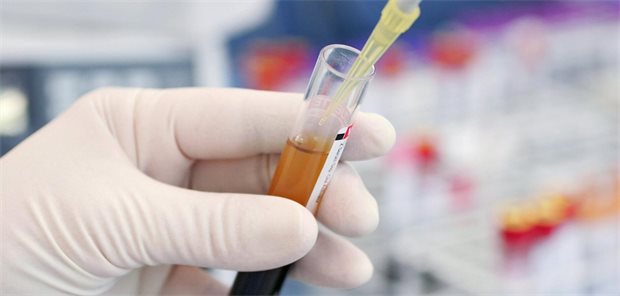 Mit der Pipette wird eine Flüssigkeit aus einem Reagenzglas gezogen