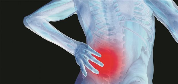 Immer wieder ein differenzialdiagnostisches Problem: akute Rückenschmerzen.