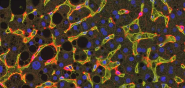 Immunfluoreszenzaufnahme einer NASH-Leber: Rot dargestellt die cDC1-Zellen, gelb die erweiterten Leberkapillaren. Fetttröpfchen sind als schwarze Kreise zu erkennen.