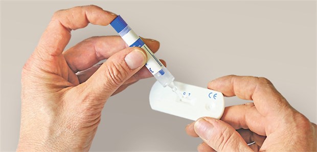 Immunologischer Stuhltest: Schnelltests werden auch in Zukunft nicht von den Krankenkassen bezahlt.