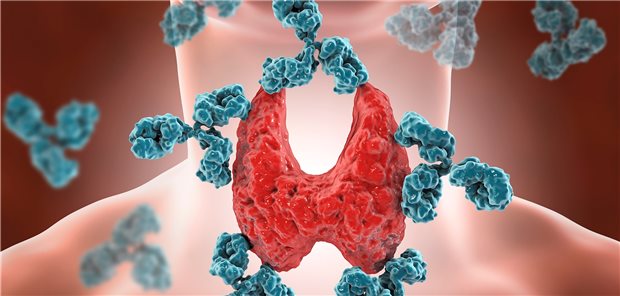 Immunsystem auf Abwegen: Bei Autoimmunthyreoiditis ist die Immuntoleranz gestört. 