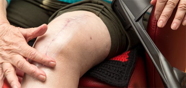 Eine Frau mit Narbe am Knie.