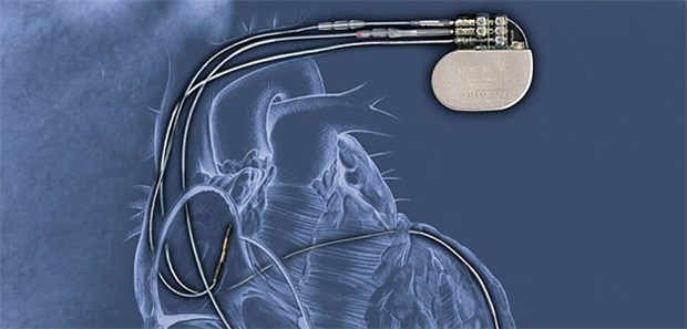 Implantierbarer Defibrillator. Erhöht die bekannte arrhythmogene Wirkung von Digitalispräparaten die Mortalität von ICD-Patienten?