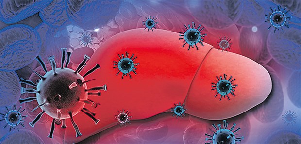 Heilung in nur sechs Wochen In 50 bis 90 Prozent der Fälle wird eine akute Hepatitis-C-Infektion chronisch.