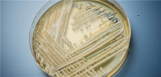 WHO warnt vor lebensgefährlichen Pilzerkrankungen In Deutschland treten immer mehr Fälle des Hefepilz Candida auris auf. Infizierte Patienten können schwer erkranken.