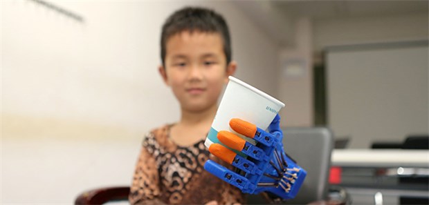 Erschwingliche Prothesen aus dem 3D-Drucker In Deutschland undenkbar, in Asien werben die Macher sogar mit dem Maschinen-Look: In jedem Fall bietet die Prothese aus dem 3D-Drucker eine Hoffnung, wo sonst kein Zugang zu einer High-Tech-Prothese vorhanden ist.
