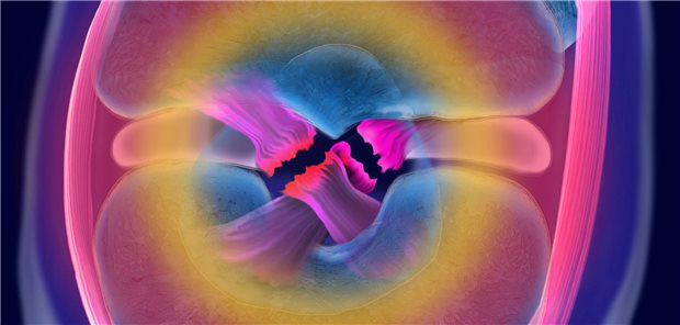 Dreidimensionale medizinische Illustration eines doppelten Kreuzbandrisses am Knie.