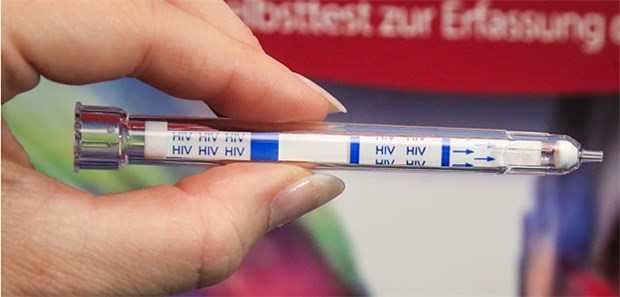 Ministerium prüft Zulassung für Hausgebrauch In Europa sind erstmals Schnelltests erhältlich, die wesentlich genauer und einfacher zu handhaben seien als frühere Tests,