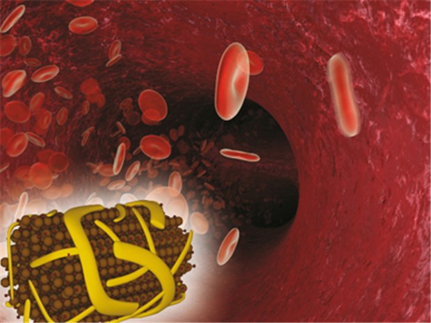 In Ferinject® halten Carboxymaltose-Streifen Eisenionen zusammen. © Vifor Pharma Deutschland