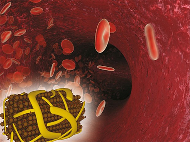 In Ferinject® sind die Eisenmoleküle in eine hochstabile Matrix aus Carboxymaltose eingebettet.