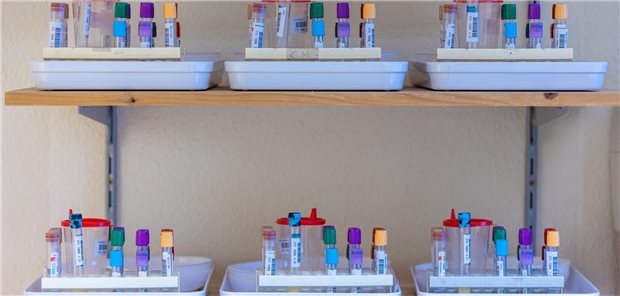 In Gefässen werden in der Unimedizin Greifswald verschiedene Proben von Teilnehmern der medizinischen Langzeitstudie für spätere Untersuchungen gesammelt. 