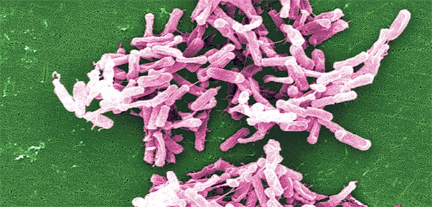 Schwere Infekte sind auf dem Vormarsch In Kliniken gefürchtet: Clostridium difficile aus einer Stuhlprobe unter dem Mikroskop.