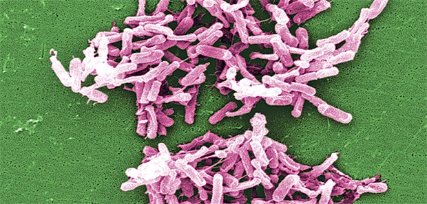 Wie Sporen vor Rückfällen schützen In Kliniken gefürchtet: Clostridium difficile aus einer Stuhlprobe unter dem Mikroskop. Nicht-toxigene Stämme des Keims werden jetzt in klinischen Studien zur Rezidivprophylaxe der Infektionen getestet.