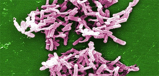 In Kliniken gefürchtet: Clostridium difficile aus einer Stuhlprobe unter dem Mikroskop.