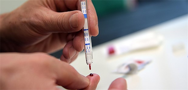 HIV-Selbsttests bald frei zugänglich? In Österreich darf bereits ein HIV-Selbsttest in Apotheken gekauft werden. Gesundheitsminister Jens Spahn (CDU) plant dies nun auch in Deutschland bis zum Herbst umzusetzen.