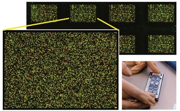 High-Tech vereinfacht Abschätzung der Prognose bei Kolonkarzinom In acht Testsystemen (rechts) sind jeweils 15 000 Gensegmente enthalten. Die Farbpunkte sind das Gentest-Ergebnis, das per Computer ausgewertet wird.