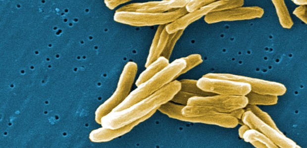 Die Inzidenz sinkt nicht mehr In bunt und trotzdem gefährlich: Mycobacterium tuberculosis.