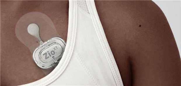 In das Rhythmuspflaster ist eine EKG-Aufzeichnungseinheit integriert, die den Herzschlag für zwei Wochen durchgehend aufzeichnet.