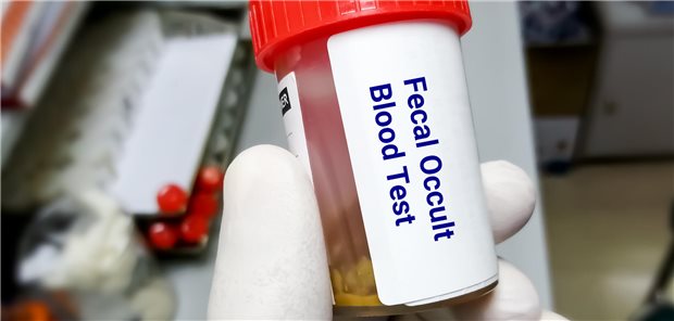 In dem Nachbeobachtungszeitraum von 14 Jahren starben 834 Personen der Expositionsgruppe, gerechnet auf 2.190.589 Personenjahre, an Darmkrebs. In der Kontrollgruppe ereigneten sich 889 Todesfälle durch Darmkrebs in 2.249.939 Personenjahren. Daraus ergab sich für die Screeninggruppe eine signifikant um 14 Prozent reduzierte darmkrebsspezifische Mortalität. Die Gesamtmortalität lag um 16 Prozent niedriger.