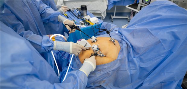 Die Hand des Arztes mit  speziellen medizinischen Instrumenten zur Durchführung einer laparoskopischen Operation