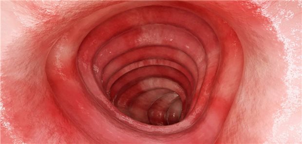 In der Darmwand schützt der erforschte Botenstoff die Epithelzellen vor dem Zelltod.