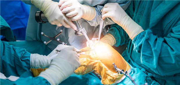 Chirurg in einem blauen Kittel führt eine Kniegelenktotalersatz bei einem Patienten in einem im Operationssaal durch.
