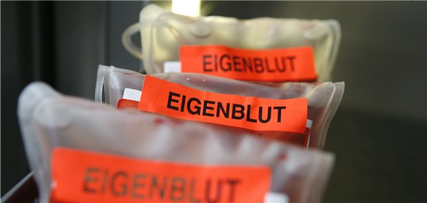 In der Heilpraktikerszene wird schon länger über die Vor- und Nachteile der Eigenbluttherapie gestritten.